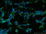 FGFR1 Antibody in Immunocytochemistry (ICC/IF)