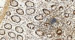 FGFR1 Antibody in Immunohistochemistry (Paraffin) (IHC (P))