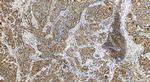 RB1 Antibody in Immunohistochemistry (Paraffin) (IHC (P))