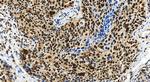 RB1 Antibody in Immunohistochemistry (Paraffin) (IHC (P))