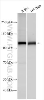 RB1 Antibody in Western Blot (WB)