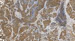 RB1 Antibody in Immunohistochemistry (Paraffin) (IHC (P))