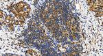 RB1 Antibody in Immunohistochemistry (Paraffin) (IHC (P))