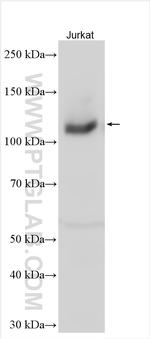 RB1 Antibody in Western Blot (WB)