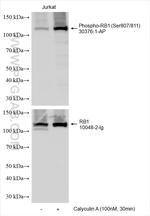 Phospho-RB1 (Ser807, Ser811) Antibody in Western Blot (WB)
