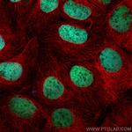 CDX2 Antibody in Immunocytochemistry (ICC/IF)