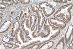 CDX2 Antibody in Immunohistochemistry (Paraffin) (IHC (P))