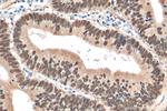CDX2 Antibody in Immunohistochemistry (Paraffin) (IHC (P))