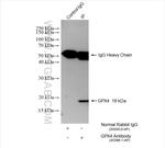 GPX4 Antibody in Immunoprecipitation (IP)