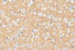 Bassoon Antibody in Immunohistochemistry (Paraffin) (IHC (P))