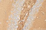 Bassoon Antibody in Immunohistochemistry (Paraffin) (IHC (P))