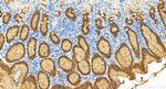 MUC5AC Antibody in Immunohistochemistry (Paraffin) (IHC (P))