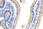 MUC5AC Antibody in Immunohistochemistry (Paraffin) (IHC (P))