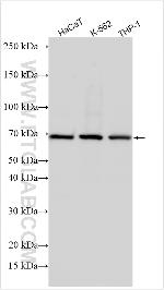 Haptoglobin Antibody in Western Blot (WB)