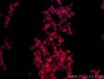 CCR2 Antibody in Immunocytochemistry (ICC/IF)