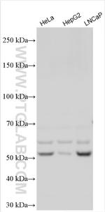 PFKFB2 Antibody in Western Blot (WB)
