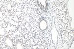 CTCF Antibody in Immunohistochemistry (Paraffin) (IHC (P))