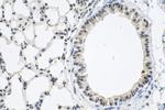 CTCF Antibody in Immunohistochemistry (Paraffin) (IHC (P))