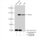CTCF Antibody in Immunoprecipitation (IP)