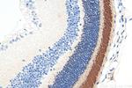 Rhodopsin Antibody in Immunohistochemistry (Paraffin) (IHC (P))