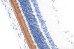 Rhodopsin Antibody in Immunohistochemistry (Paraffin) (IHC (P))