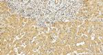 USP6NL Antibody in Immunohistochemistry (Paraffin) (IHC (P))