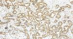 USP6NL Antibody in Immunohistochemistry (Paraffin) (IHC (P))