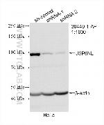 USP6NL Antibody in Western Blot (WB)