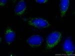 CEP295 Antibody in Immunocytochemistry (ICC/IF)