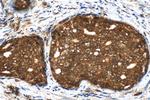 CEP295 Antibody in Immunohistochemistry (Paraffin) (IHC (P))