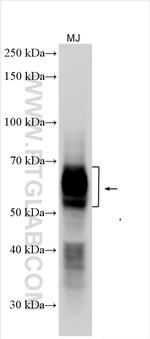 CD25/IL2RA Antibody in Western Blot (WB)