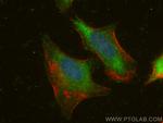 CDC20 Antibody in Immunocytochemistry (ICC/IF)