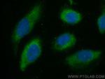 CDC20 Antibody in Immunocytochemistry (ICC/IF)