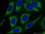 MUC20 Antibody in Immunocytochemistry (ICC/IF)