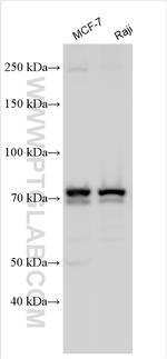 FBXO7 Antibody in Western Blot (WB)