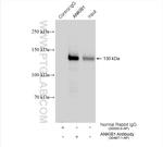 ANKIB1 Antibody in Immunoprecipitation (IP)