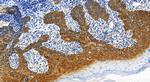 GSDMC Antibody in Immunohistochemistry (Paraffin) (IHC (P))
