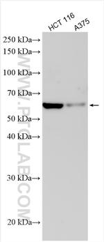 GSDMC Antibody in Western Blot (WB)