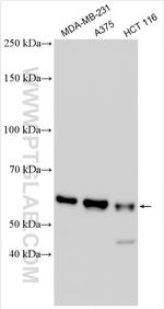 GSDMC Antibody in Western Blot (WB)