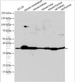 B4GALT4 Antibody in Western Blot (WB)
