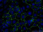 ZO-1 Antibody in Immunocytochemistry (ICC/IF)