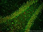 NRXN2 Antibody in Immunohistochemistry (PFA fixed) (IHC (PFA))