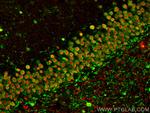 NRXN2 Antibody in Immunohistochemistry (PFA fixed) (IHC (PFA))