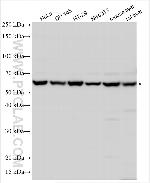 CSN2 Antibody in Western Blot (WB)