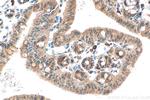 ARHGEF11 Antibody in Immunohistochemistry (Paraffin) (IHC (P))