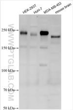 ARHGEF11 Antibody in Western Blot (WB)