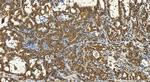SEC23B Antibody in Immunohistochemistry (Paraffin) (IHC (P))