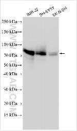 AK6 Antibody in Western Blot (WB)