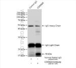 P16-INK4A Antibody in Immunoprecipitation (IP)