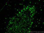 ACIN1-L Antibody in Immunohistochemistry (PFA fixed) (IHC (PFA))